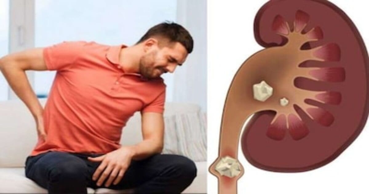 Kidney Problems